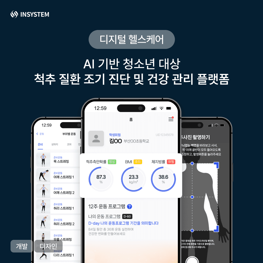 AI기반 청소년 척추 질환 조기 진단 및 건강관리 플랫폼